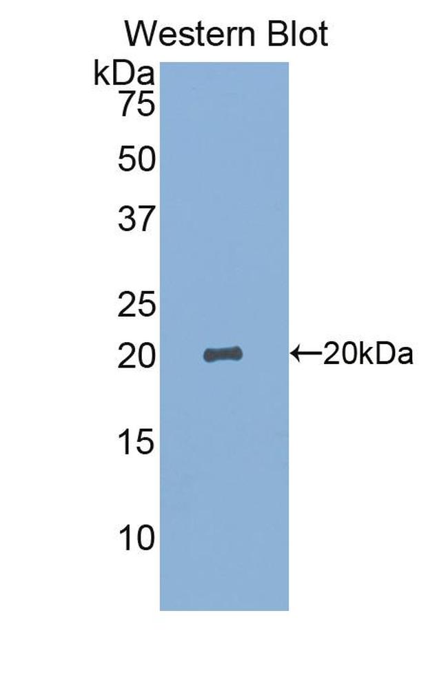 SIGLEC14 Antibody in Western Blot (WB)