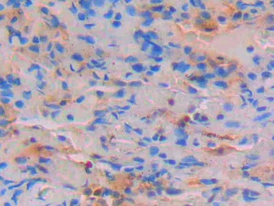 STAT4 Antibody in Immunohistochemistry (Paraffin) (IHC (P))