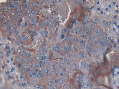 SLIT1 Antibody in Immunohistochemistry (Paraffin) (IHC (P))