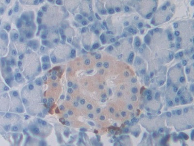 SLIT1 Antibody in Immunohistochemistry (Paraffin) (IHC (P))