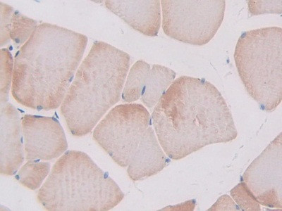 SLIT1 Antibody in Immunohistochemistry (Paraffin) (IHC (P))