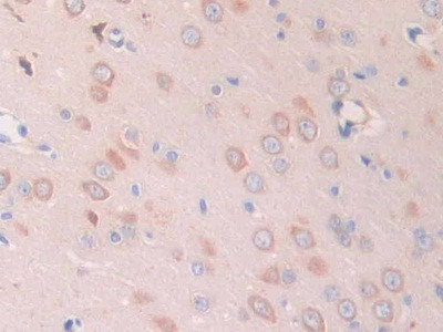 SLIT1 Antibody in Immunohistochemistry (Paraffin) (IHC (P))