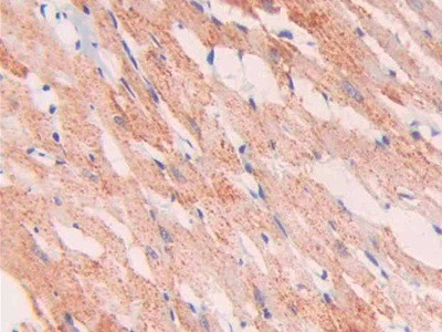 SLIT1 Antibody in Immunohistochemistry (Paraffin) (IHC (P))