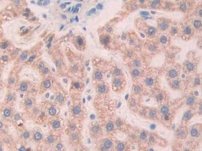 SLIT1 Antibody in Immunohistochemistry (Paraffin) (IHC (P))