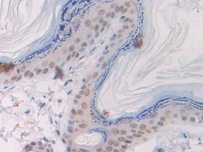 SLIT1 Antibody in Immunohistochemistry (Paraffin) (IHC (P))