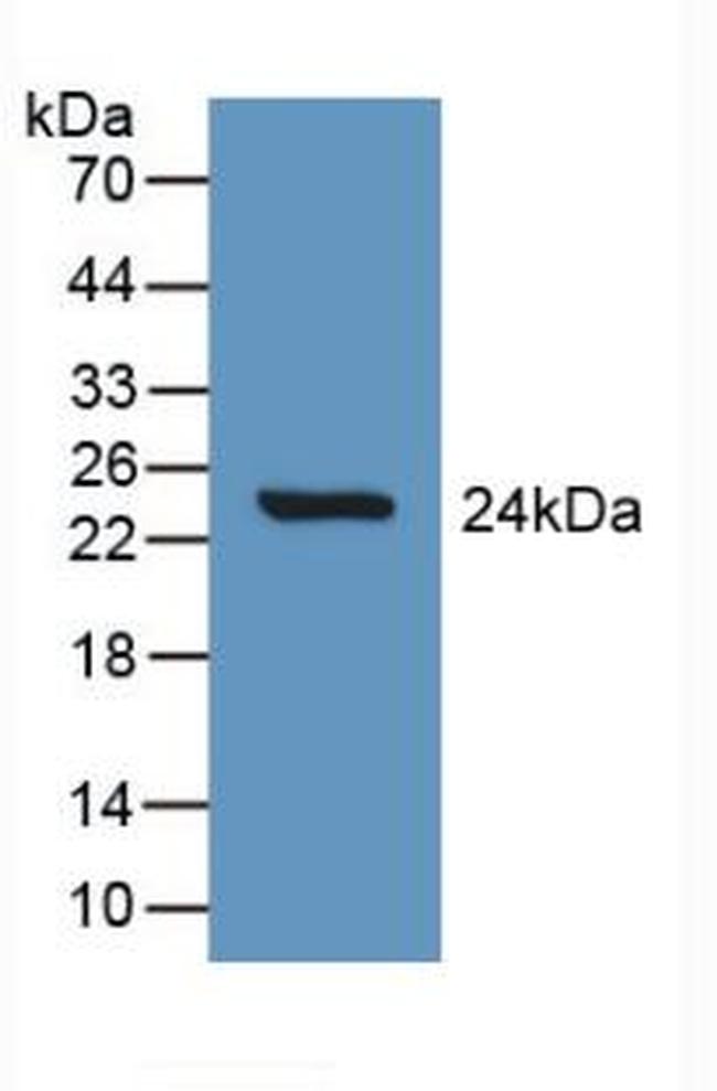 SLIT1 Antibody in Western Blot (WB)