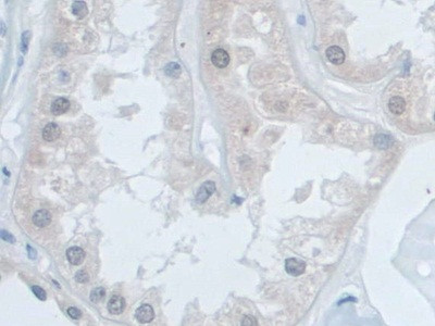 SNRPD1 Antibody in Immunohistochemistry (Paraffin) (IHC (P))