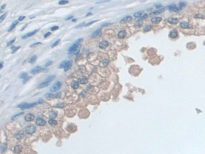 SNRPD1 Antibody in Immunohistochemistry (Paraffin) (IHC (P))