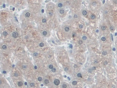 SNRPD1 Antibody in Immunohistochemistry (Paraffin) (IHC (P))