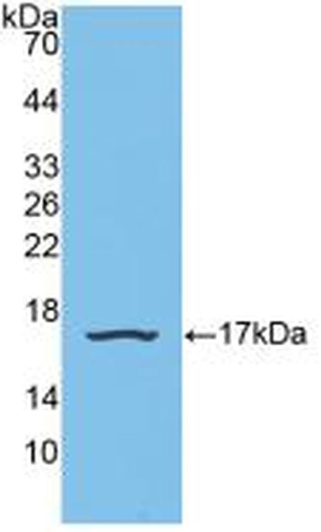 SNRPD1 Antibody in Western Blot (WB)