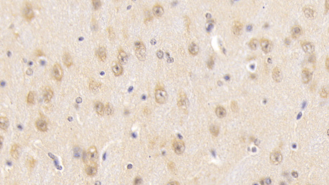 SNUPN Antibody in Immunohistochemistry (Paraffin) (IHC (P))