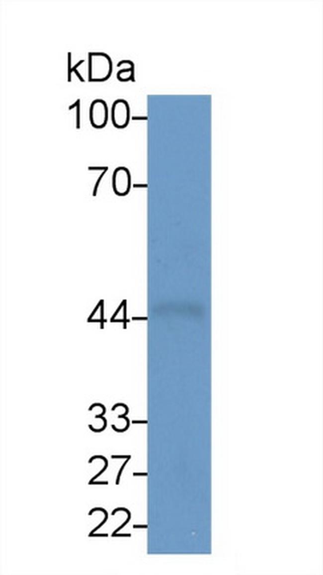 SNUPN Antibody in Western Blot (WB)