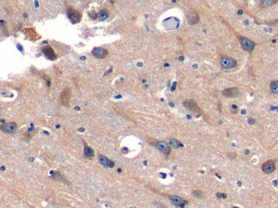 SNUPN Antibody in Immunohistochemistry (Paraffin) (IHC (P))