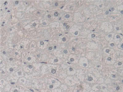 SKP1 Antibody in Immunohistochemistry (Paraffin) (IHC (P))