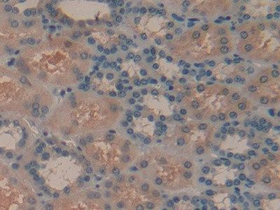 Syk Antibody in Immunohistochemistry (Paraffin) (IHC (P))