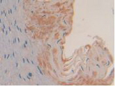 Syk Antibody in Immunohistochemistry (Paraffin) (IHC (P))