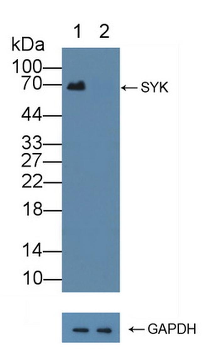 Syk Antibody in Western Blot (WB)