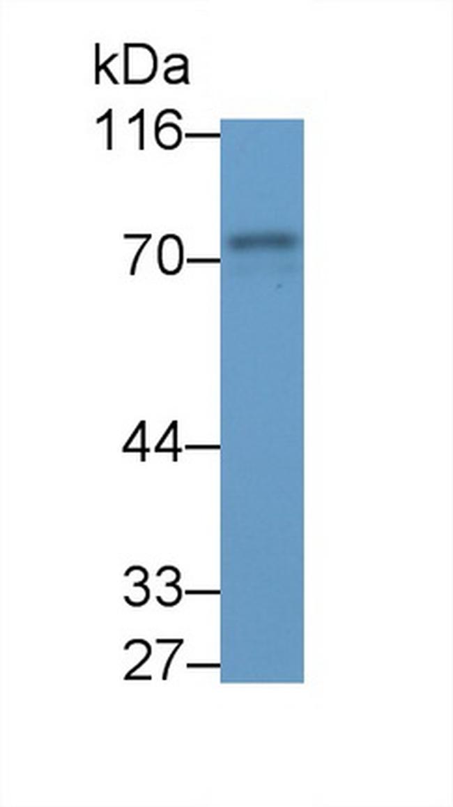 Syk Antibody in Western Blot (WB)