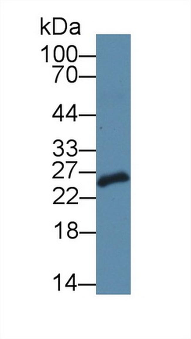 SDF2L1 Antibody in Western Blot (WB)