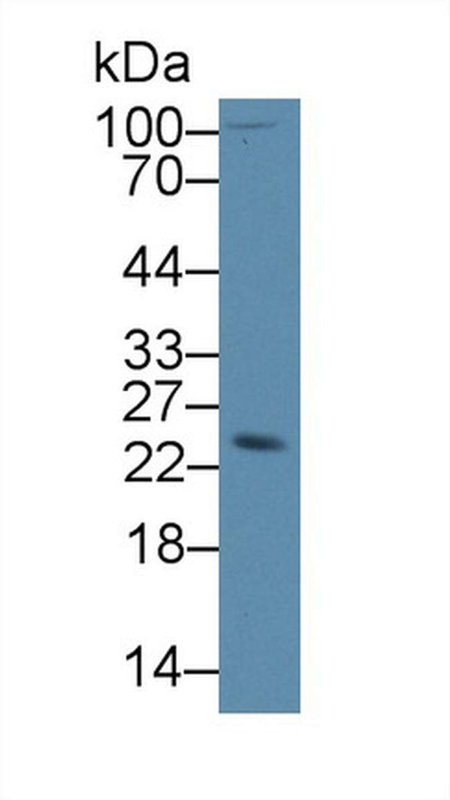 SDF2L1 Antibody in Western Blot (WB)