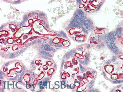 SULF2 Antibody in Immunohistochemistry (Paraffin) (IHC (P))