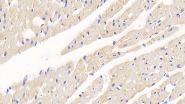 SOD2 Antibody in Immunohistochemistry (Paraffin) (IHC (P))