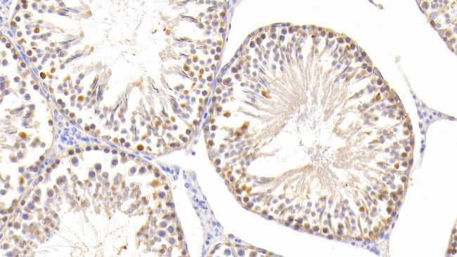 SOD2 Antibody in Immunohistochemistry (Paraffin) (IHC (P))