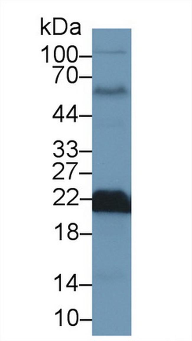 SOD2 Antibody in Western Blot (WB)