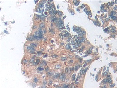 SOD2 Antibody in Immunohistochemistry (Paraffin) (IHC (P))