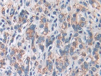 SOD2 Antibody in Immunohistochemistry (Paraffin) (IHC (P))