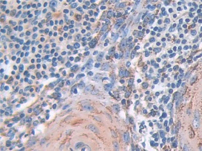 SOD2 Antibody in Immunohistochemistry (Paraffin) (IHC (P))