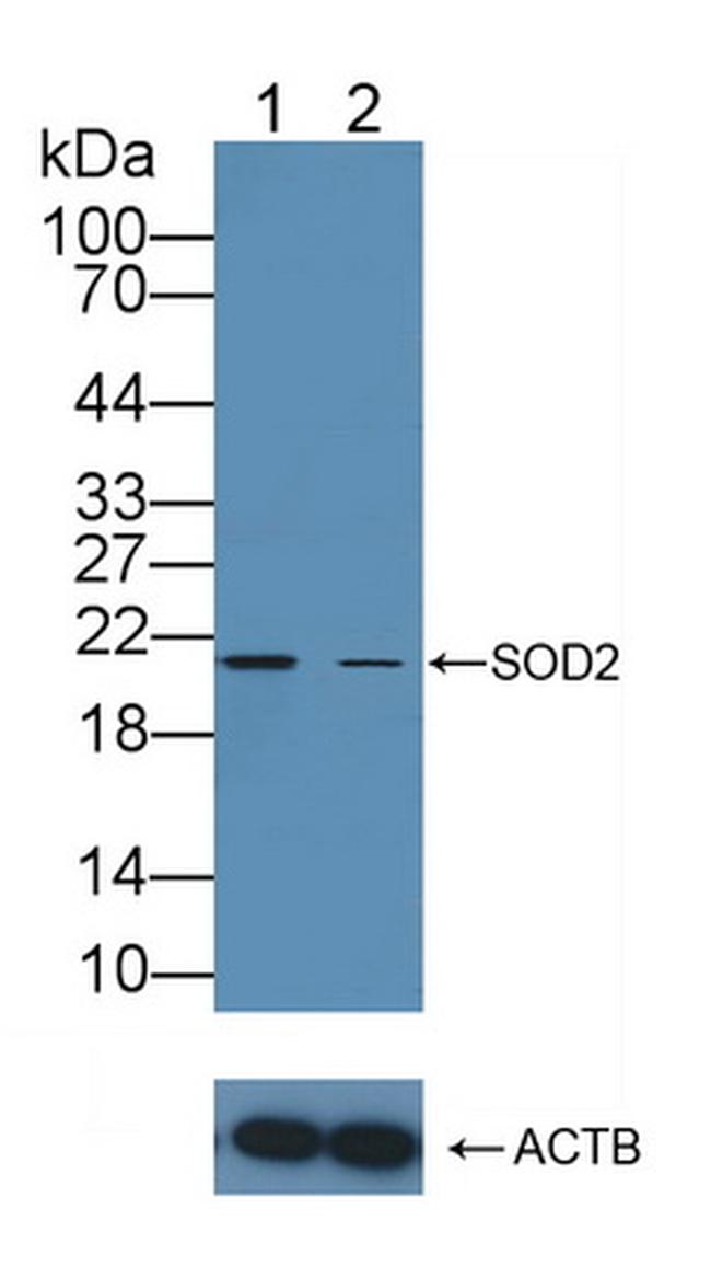 SOD2 Antibody in Western Blot (WB)