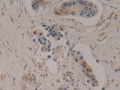 CCS Antibody in Immunohistochemistry (Paraffin) (IHC (P))