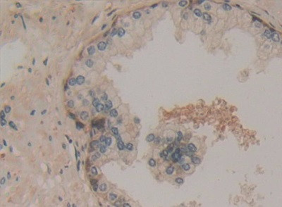 CCS Antibody in Immunohistochemistry (Paraffin) (IHC (P))