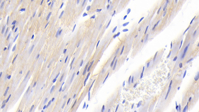 SOCS2 Antibody in Immunohistochemistry (Paraffin) (IHC (P))