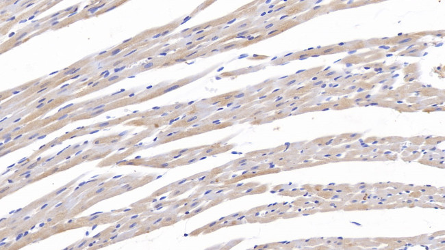 Tenascin C Antibody in Immunohistochemistry (Paraffin) (IHC (P))