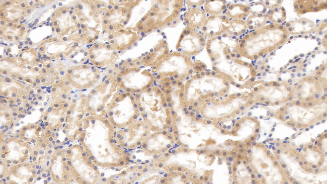 Tenascin C Antibody in Immunohistochemistry (Paraffin) (IHC (P))