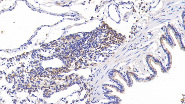 Tenascin C Antibody in Immunohistochemistry (Paraffin) (IHC (P))