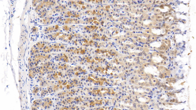 Tenascin C Antibody in Immunohistochemistry (Paraffin) (IHC (P))