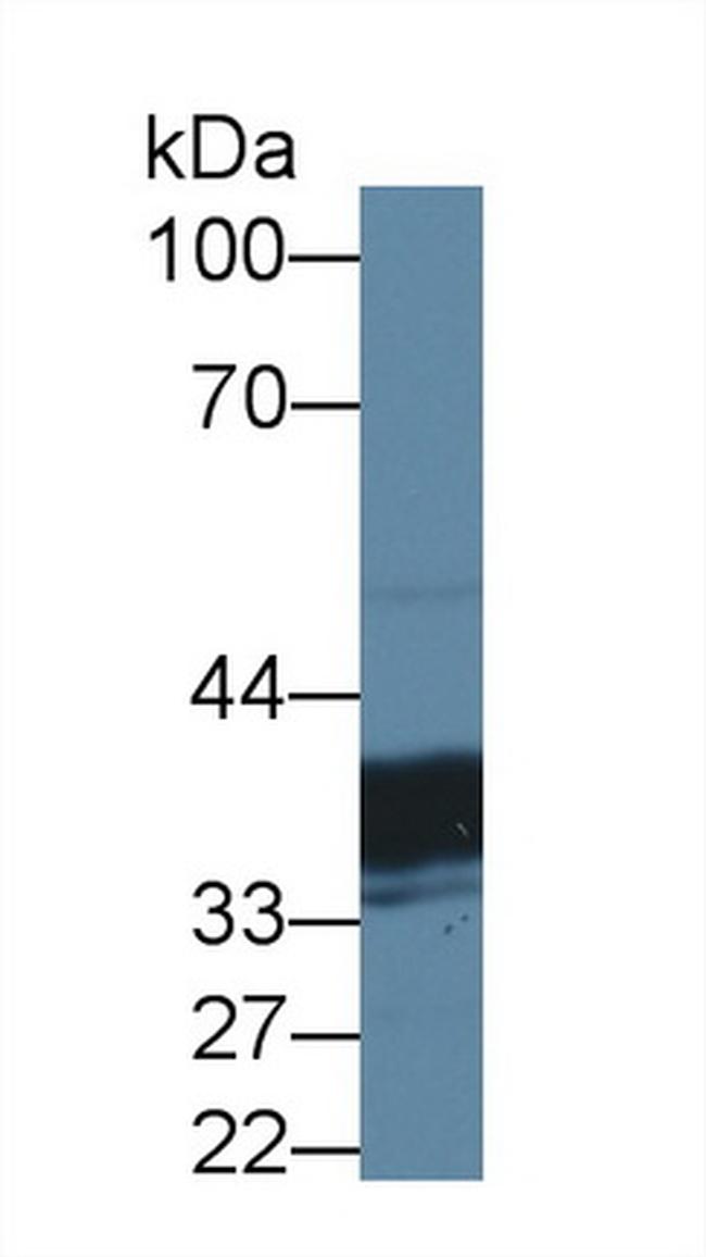 TST Antibody in Western Blot (WB)