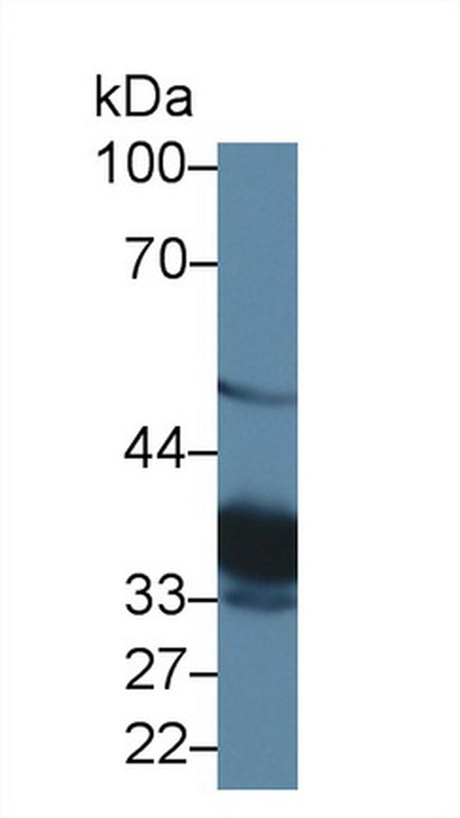 TST Antibody in Western Blot (WB)