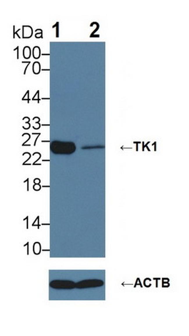 TK1 Antibody in Western Blot (WB)