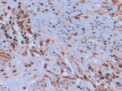 Thymidylate Synthase Antibody in Immunohistochemistry (Paraffin) (IHC (P))