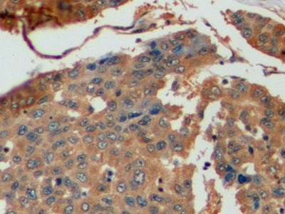 Thymidylate Synthase Antibody in Immunohistochemistry (Paraffin) (IHC (P))