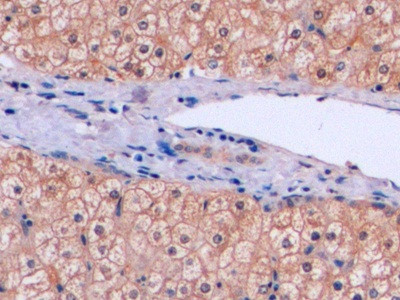 Thymidylate Synthase Antibody in Immunohistochemistry (Paraffin) (IHC (P))