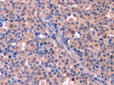 Thymidylate Synthase Antibody in Immunohistochemistry (Paraffin) (IHC (P))