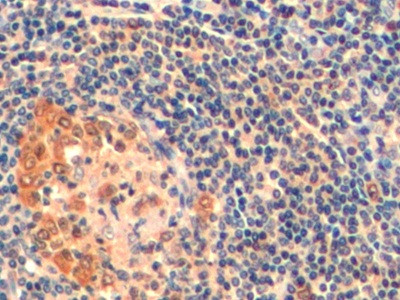 Thymidylate Synthase Antibody in Immunohistochemistry (Paraffin) (IHC (P))