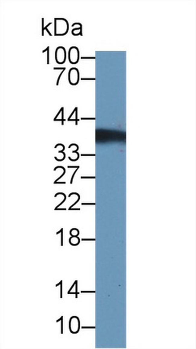 Thymidylate Synthase Antibody in Western Blot (WB)