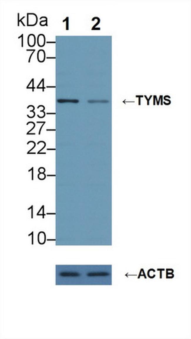 Thymidylate Synthase Antibody in Western Blot (WB)