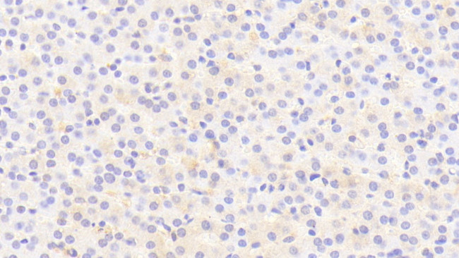 THRSP Antibody in Immunohistochemistry (Paraffin) (IHC (P))